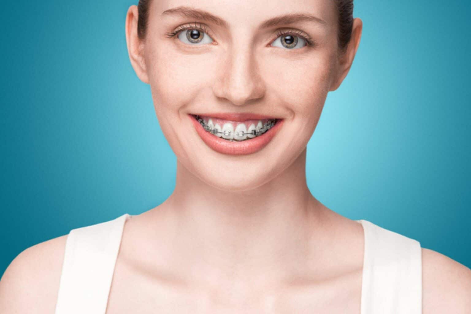 What Foods Should You Avoid With Braces? Waddoups Orthodontics, in Murrieta and Corona, CA