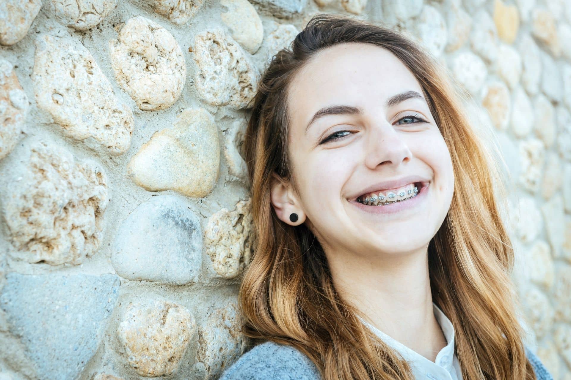 How Can Teens and Adults Feel Confident With Braces? Waddoups Orthodontics in Murrieta, CA