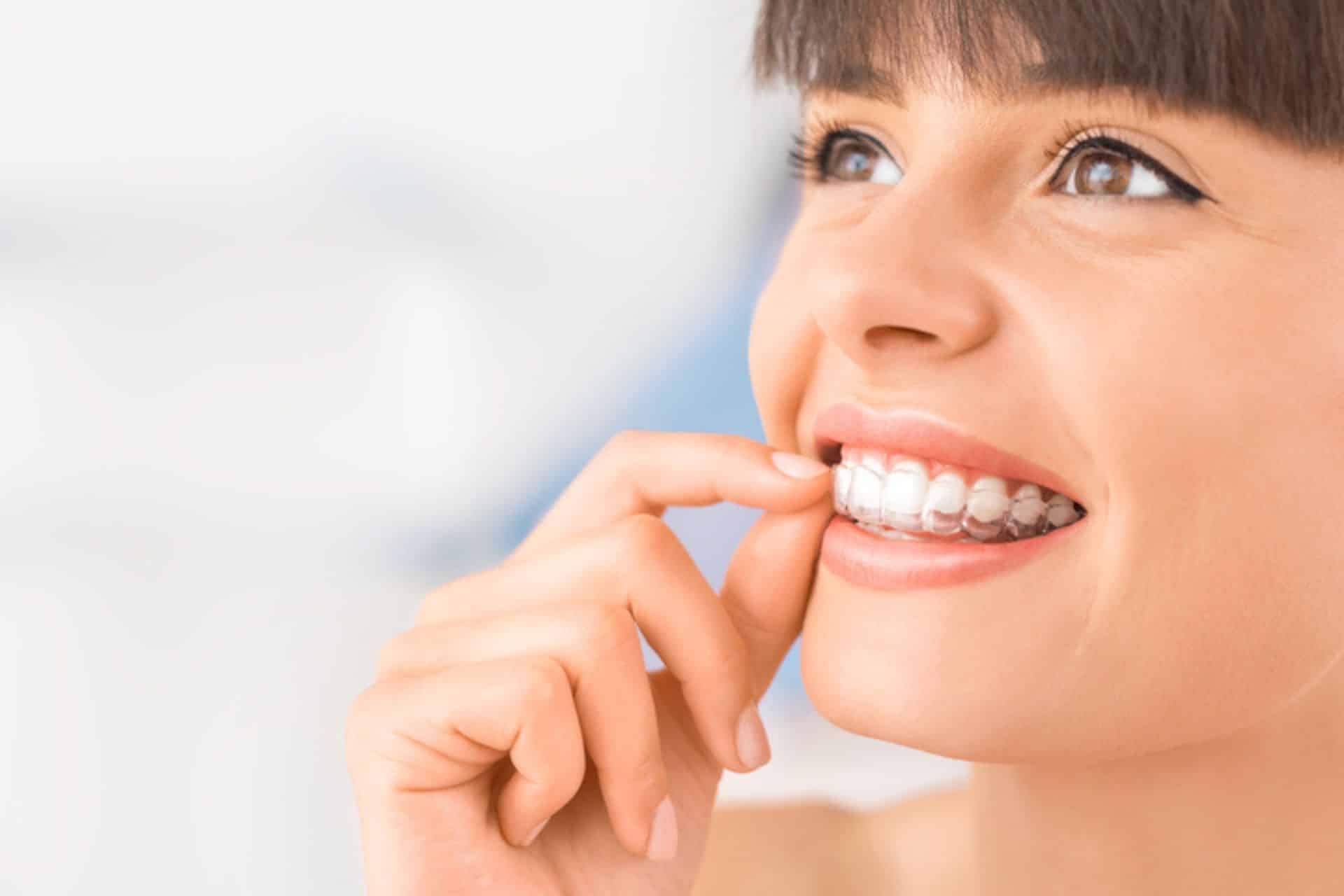 What Should I Know Before Starting Invisalign? Waddoups Orthodontics in Corona, CA