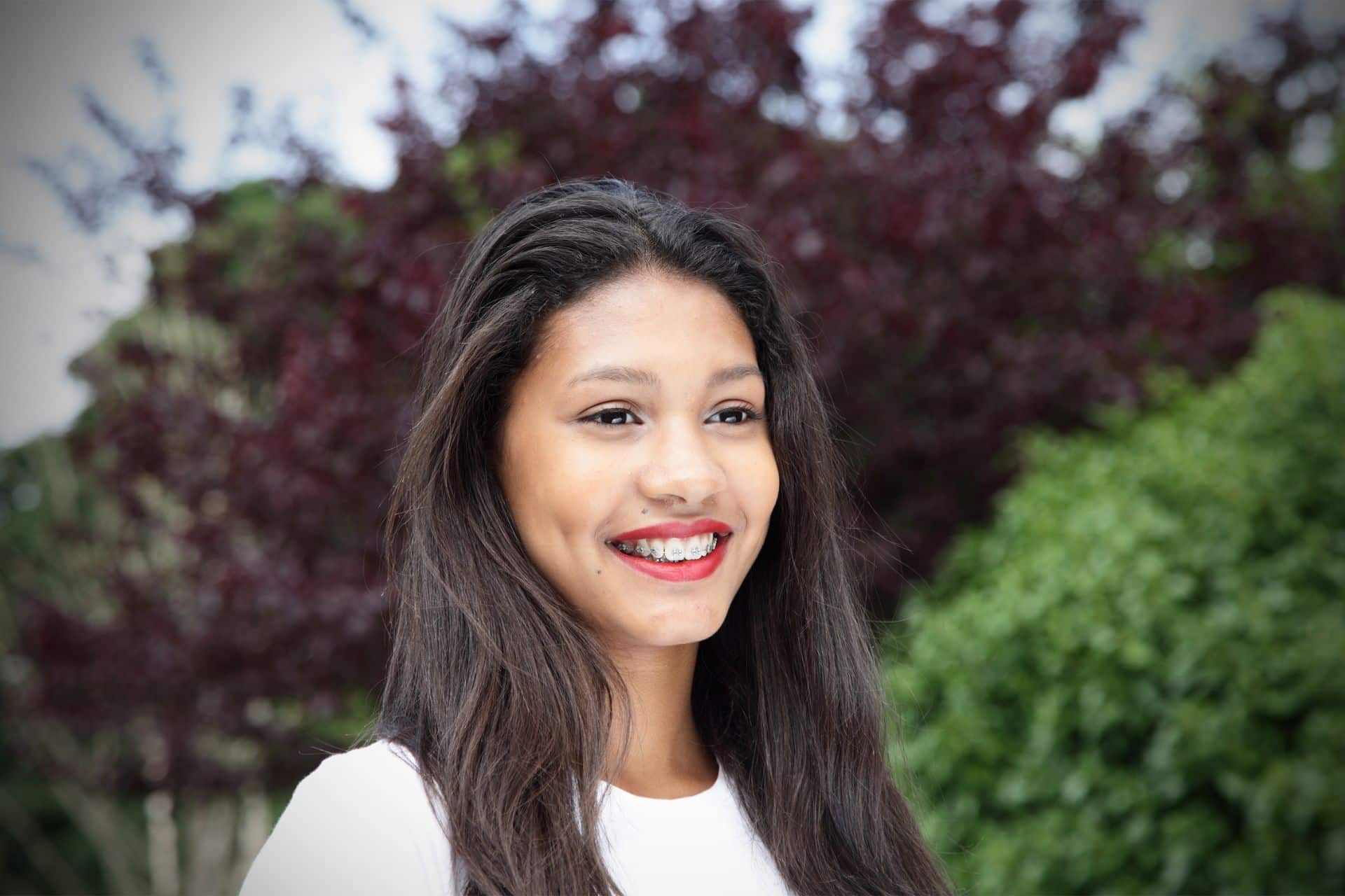 ¿Por qué se forman manchas blancas en los dientes con aparato? Ortodoncia Waddoups en Corona, CA