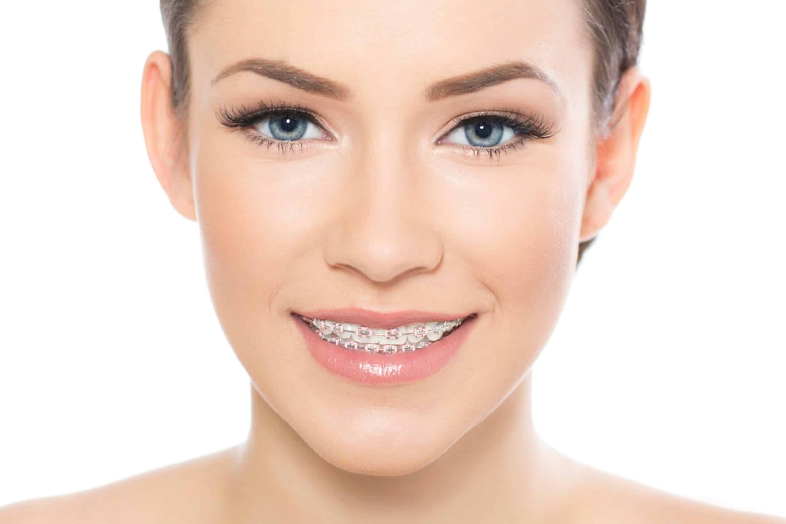 How Do Orthodontists Create a Treatment Plan in Murrieta, CA? Corona, CA
